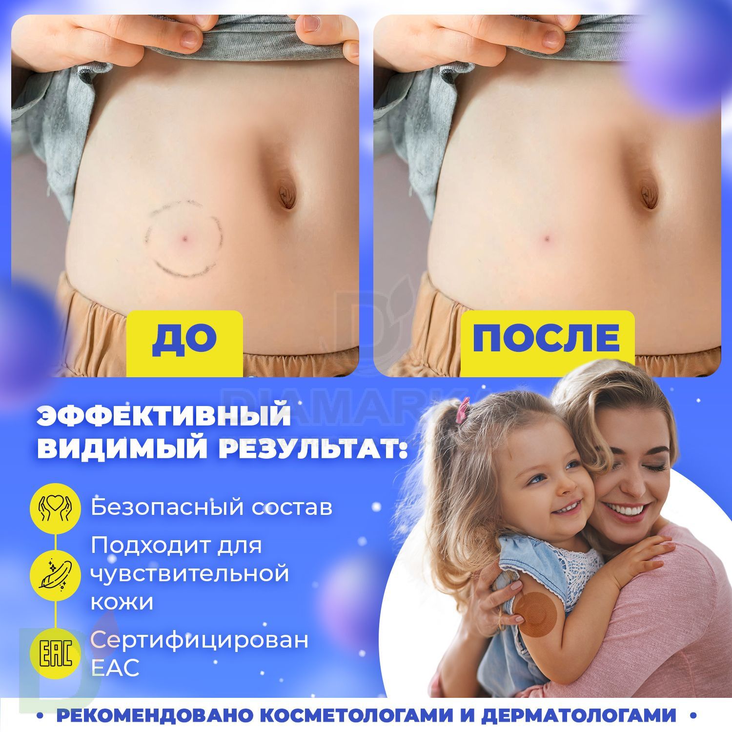 Ремувер 4SKINcare для удаления FreeStyle Libre Лимонная карамель, 115 мл